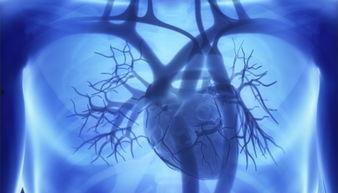 国产瓣膜介入视频,创新突破，守护心健康